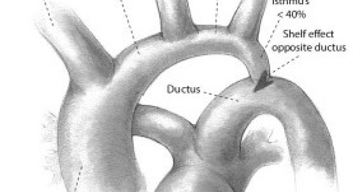 segments of the aorta