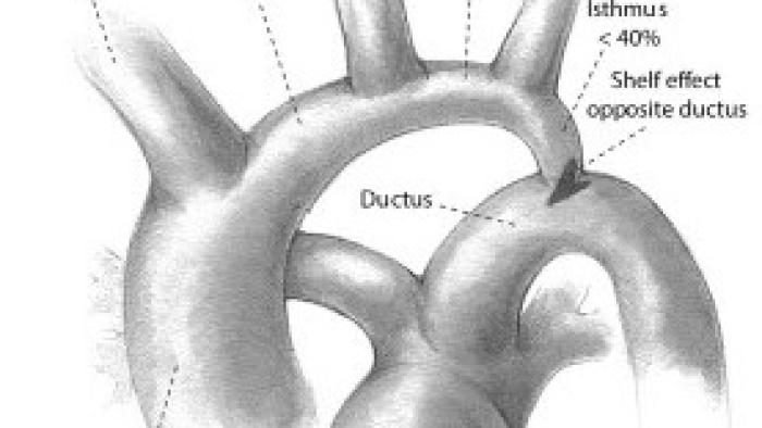 segments of the aorta